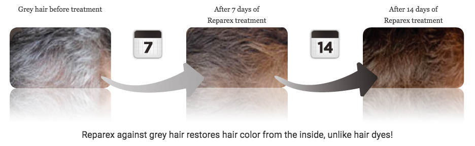 레파렉스,리파렉스,reparex,흰머리에좋은음식,흰머리약,흰머리치료,흰머리치료약,흰머리치료법,흰머리치료방법,흰머리없애주는약,흰머리제거약