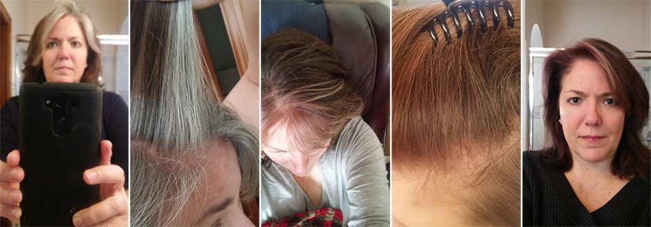 레파렉스,리파렉스,reparex,흰머리에좋은음식,흰머리약,흰머리치료,흰머리치료약,흰머리치료법,흰머리치료방법,흰머리없애주는약,흰머리제거약