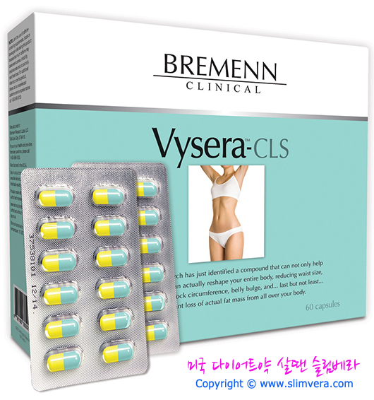 벤츠 다이어트, 벤츠 다이어트약, 비세라 다이어트, 비세라, vysera, vysera cls, vysera-cls, bremenn clinical, bremenn, 바이세라, 바이세라 다이어트, 바이세라 cls